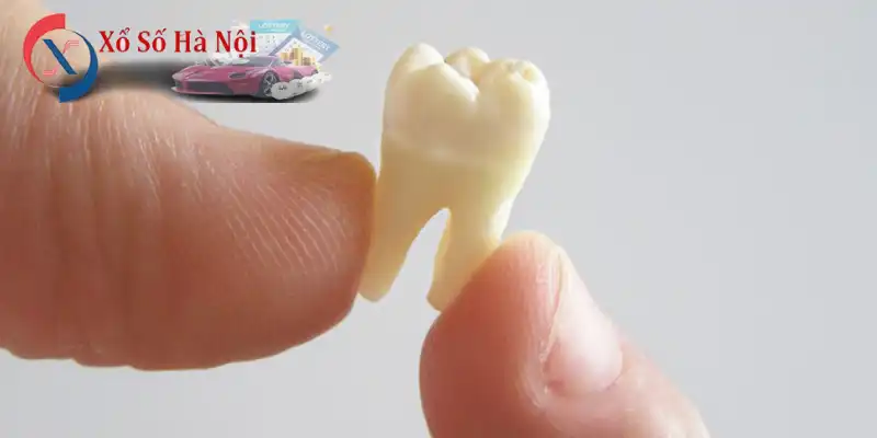 Nằm Mơ Rụng 1 Cái Răng Đánh Đề Con Gì